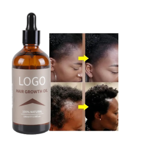 Hair Growth Oil